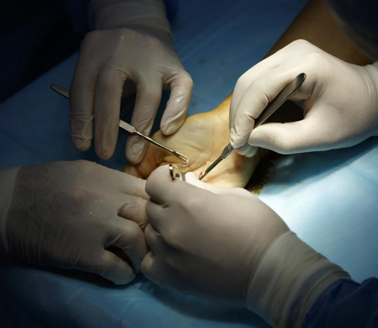 cirugia-mano-1
